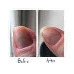 herome kit essentiels ongles abimes – image 2